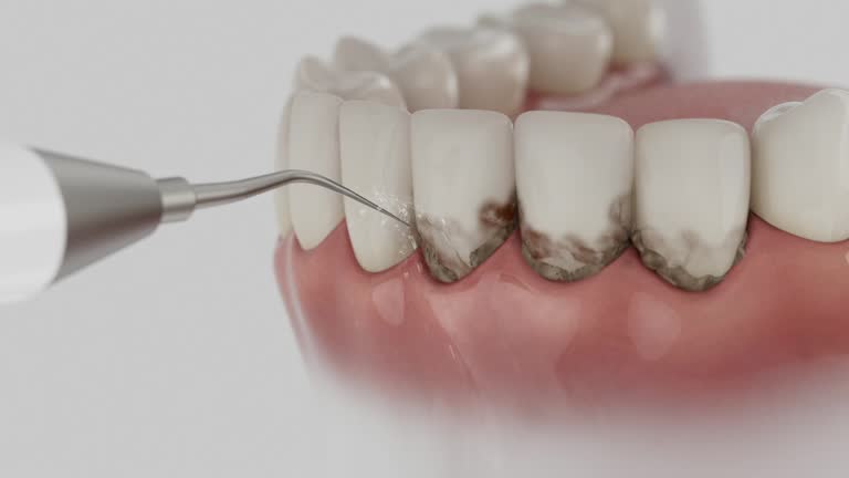Reliable Dental Implants contractor in Queen Creek, AZ by Smile Center Dentistry